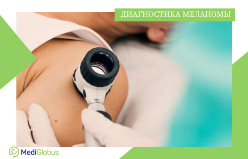 Диагностика меланомы