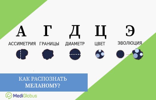 Как распознать рак кожи?
