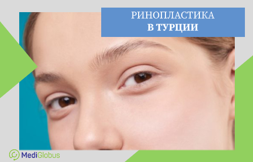 Ринопластика в Турции