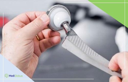 Протез для тазобедренного сустава