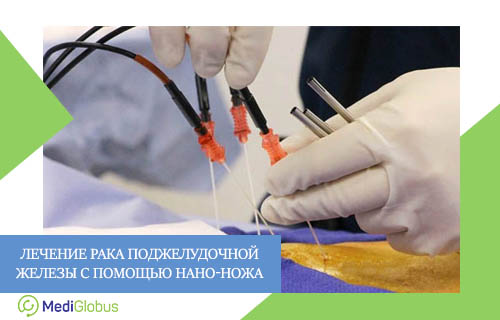 нано-нож при лечении рака поджелудочной