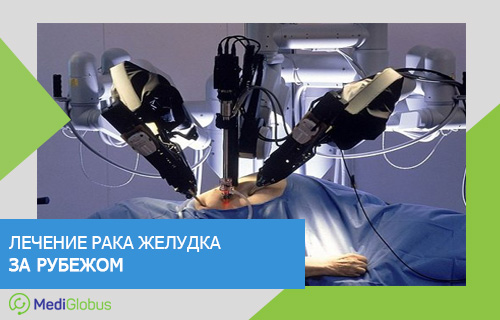 роботизированная система да винсчи при лечении рака желудка