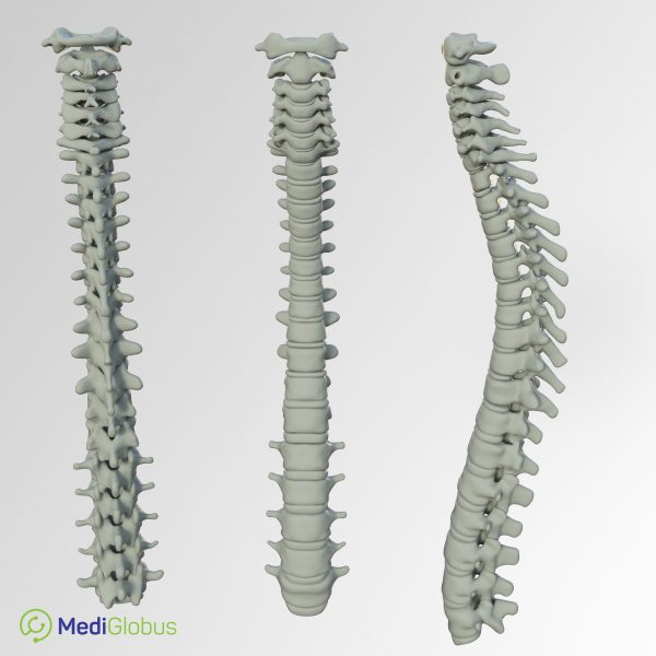 TREATMENT OF INTERVERTEBRAL HERNIA WITHOUT SURGERY