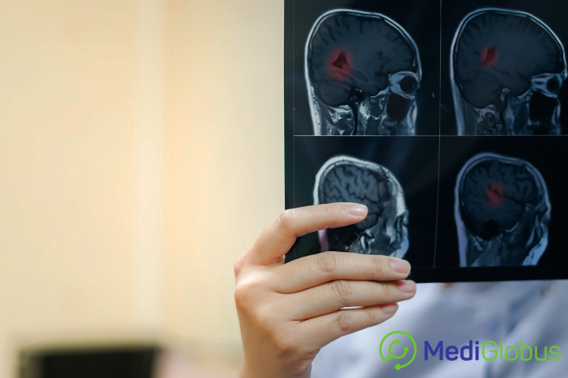 Диагностика эпилепсии у детей и взрослых