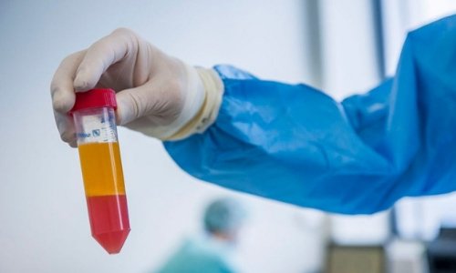 Лечение стволовыми клетками в Cellthera Center