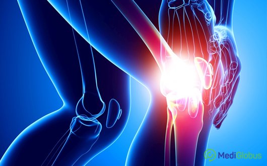 Treatment of Joints Abroad. Arthritis, Arthrosis and Rheumatism