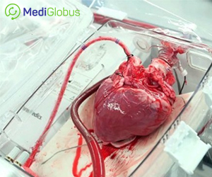 Best clinics for organ transplants in India