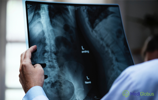 Modern Spinal Neurosurgery Methods