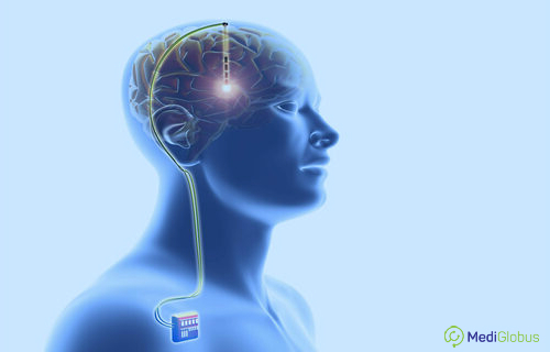 Neurological diseases and modern therapy