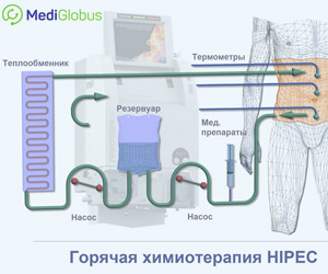 как делается горячая химия