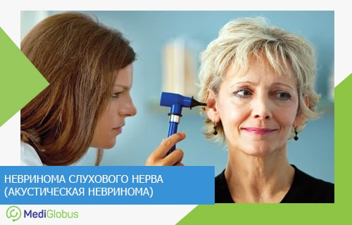 дечение и диагностика акустической невриномы за рубежом