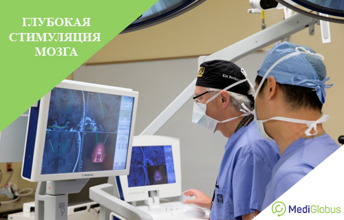 процедура глубокой стимуляции мозга