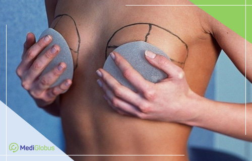 маммопластика за рубежом