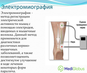 электромиеграфия за границей