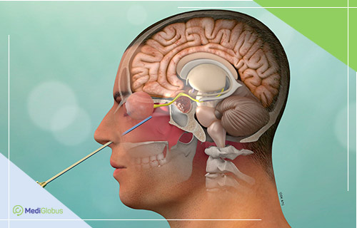 Риски и успехи операции по удалению гипофиза