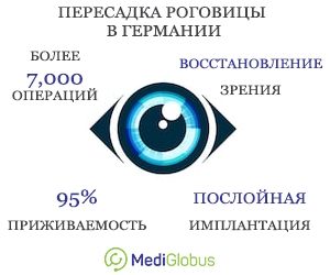 удобства трансплантации роговицы в германии