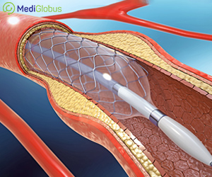 лечение ишемической болезни сердца