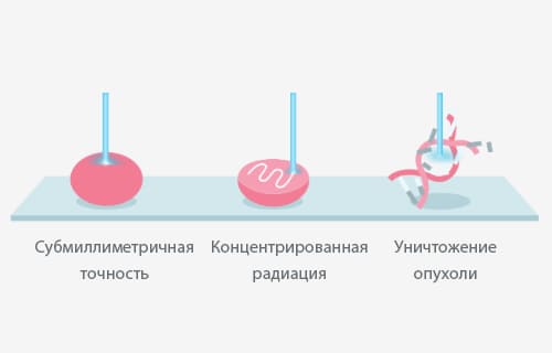 преимущества протонной терапии