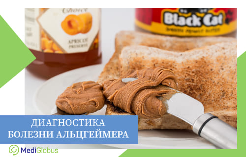 Методы ранней диагностики болезни Альцгеймера
