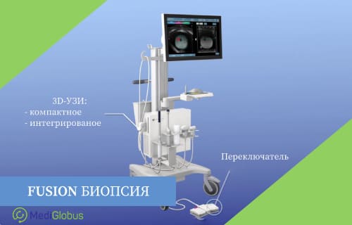 фьюжн биопсия рака простаты диагностика за рубежом