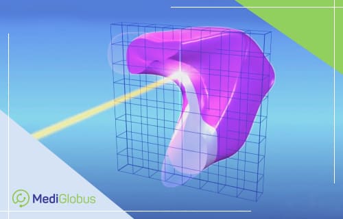 что такое сканирование карандашным пучком протонная терапия