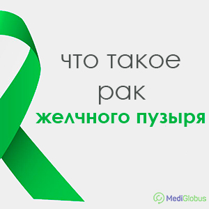 опухоль желчного пузыря, онкология желчного пузыря, рак желчных протоков