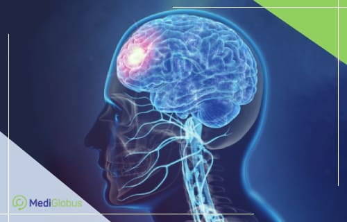 transcranial magnetic stimulation TMS abroad