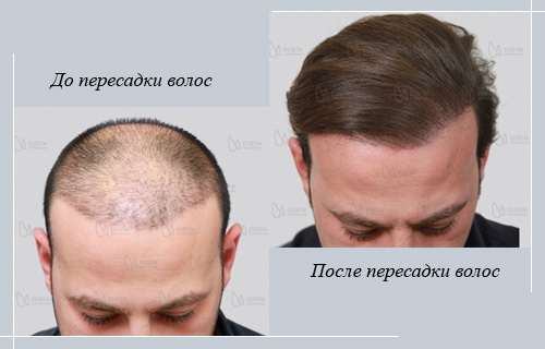 Клиника Эстетик Интернешл Бурса