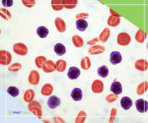 острая лимфоцитарная лейкемия