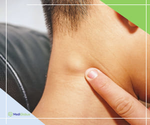 фолликулярная лимфома у взрослых