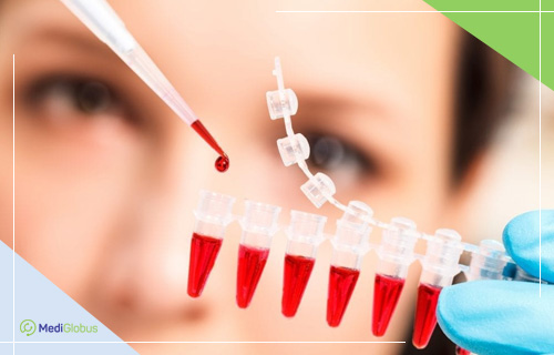 трансплантация костного мозга при первичной лимфоме цнс