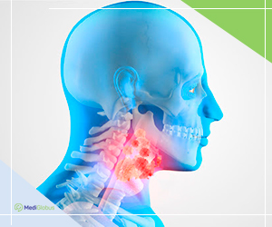 опухоль головы и шеи фото